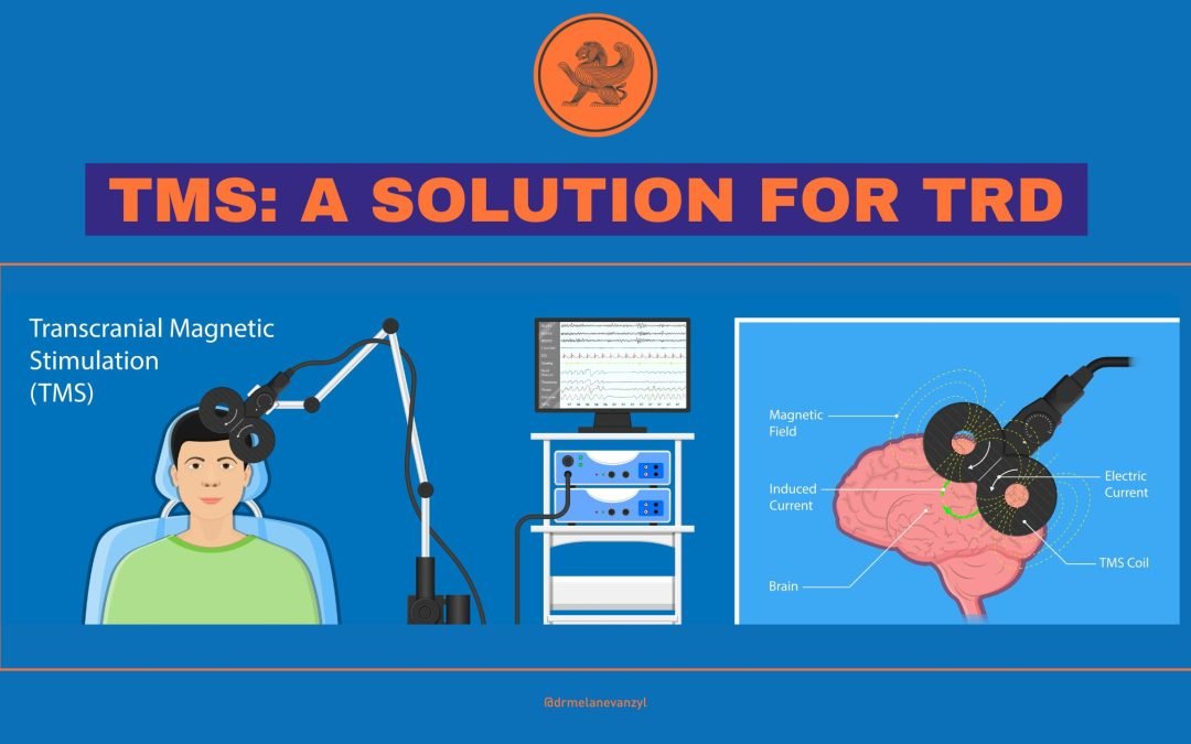 Transcranial Magnetic Stimulation (TMS): An option for Treatment-Resistant Depression